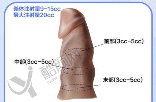 重庆松山医院罗会良：胸部整形实例