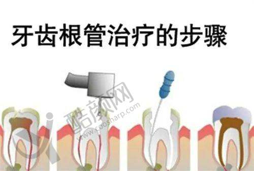 临汾美瑞臣口腔医院根管治疗医生风采