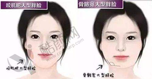 一、长沙星雅整形医院怎么样？