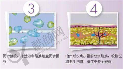 重庆松山医院罗会良：胸部整形水平怎么样可靠吗？