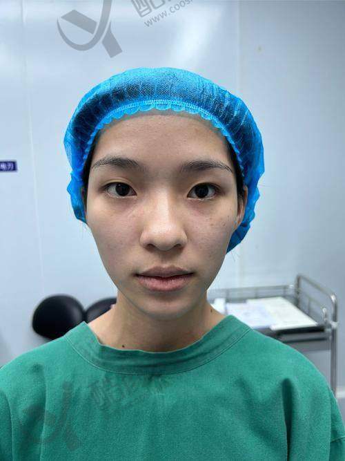 何军鼻整形水平怎么样可靠吗？