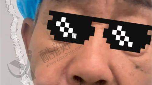 王阔远医生面部减容价格：透明合理有保护