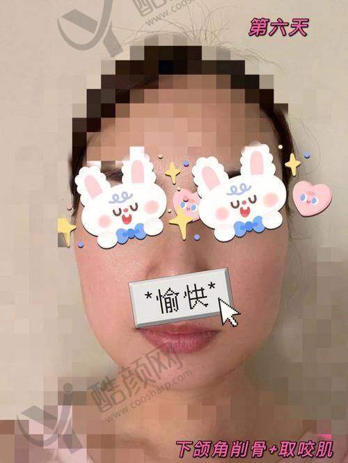 重庆松山医院苟磊口碑和评价