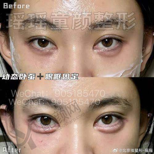 重庆松山医院罗会良：项目价格表参考