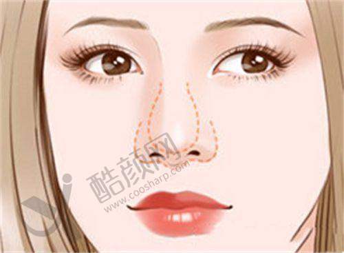 六、福州名韩医疗美容门诊部怎么预约：