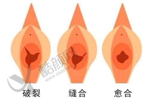 八、广州建国医院私密整形中 心真实的顾客评价如下：