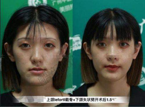 三、郑州大学第二附属医院正美医疗美容医生介绍: