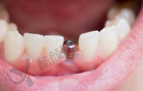 王建超项目价格表参考