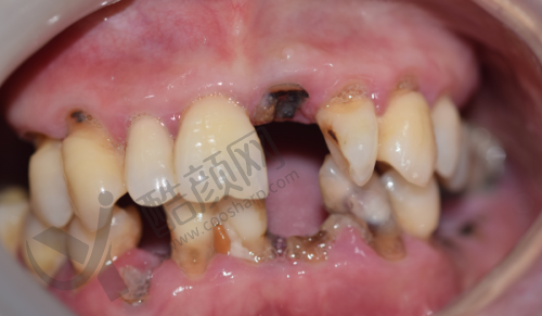 德州可恩口腔王涛在哪家医院