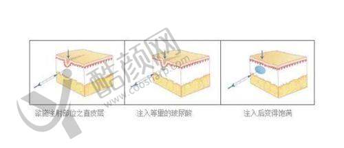 六、贵阳美贝尔整形医院怎么预约：