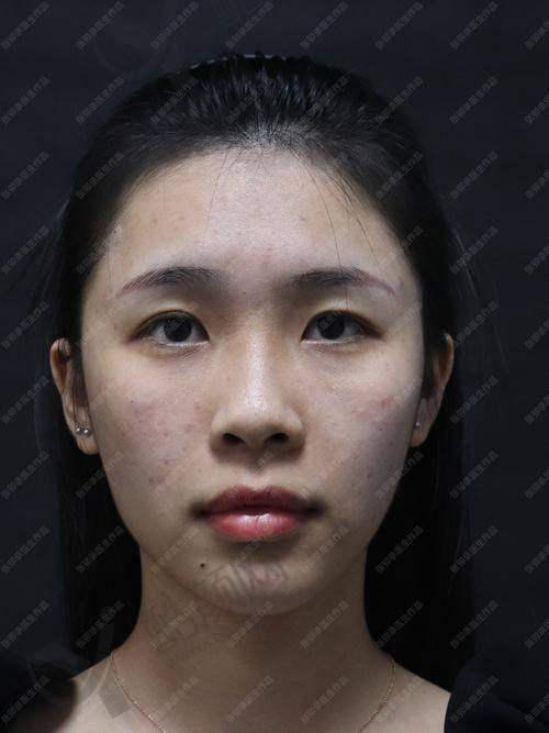 五、成都童颜博仕医疗美容诊所怎么预约：