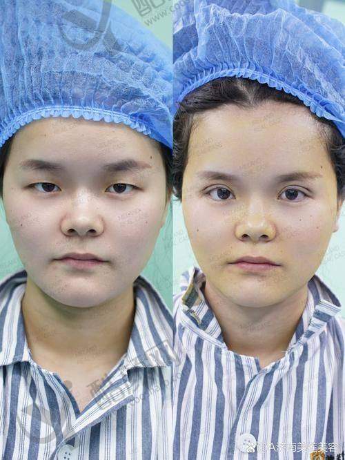 三、成都童颜博仕医疗美容诊所实例