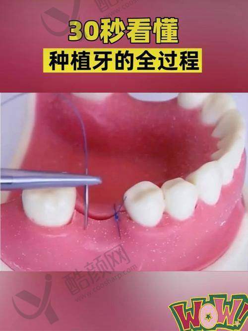 德州可恩口腔王涛项目价格表参考