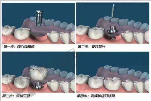 曾振钰副院长口碑和评价