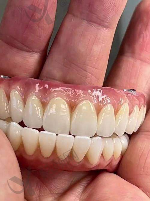 临汾美瑞臣口腔医院镶烤瓷牙价格720元起,种植牙性价比高、隐形矫正技术成熟!