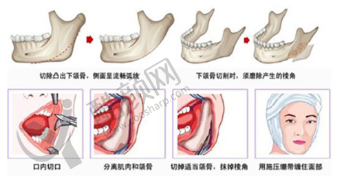 六、拉萨爱思特医疗美容医院怎么预约：