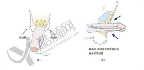 一、承德欧亚圣美医疗美容门诊部怎么样？