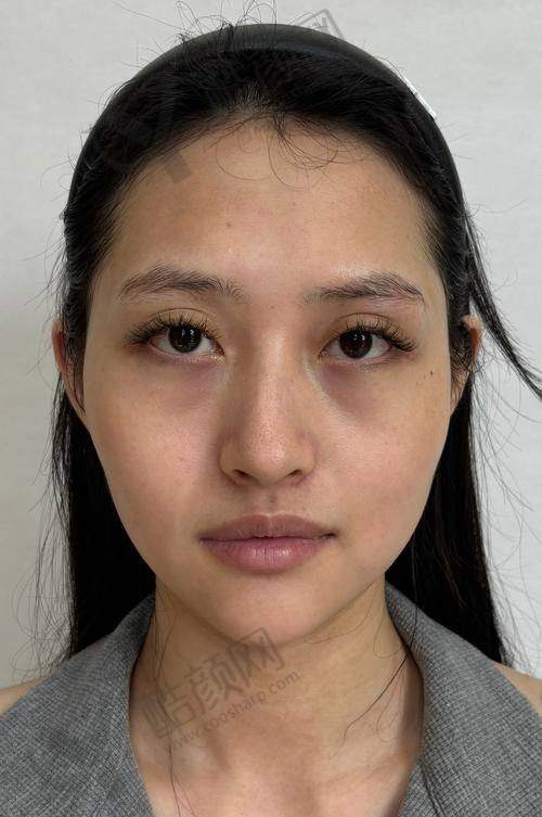 七、北京优翔瑞伊医疗美容诊所价格表：（仅供参考）