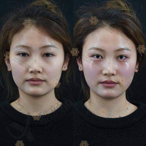 四、北京优翔瑞伊医疗美容诊所实例