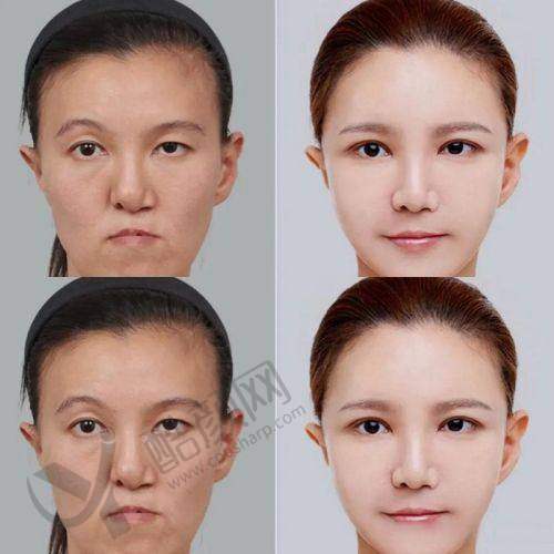 一、北京优翔瑞伊医疗美容诊所怎么样？
