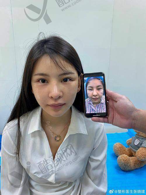 八、北京优翔瑞伊医疗美容诊所真实的顾客评价如下：