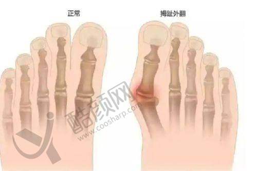 西安画美医疗美容医院李兆鹤医生成功实例与口碑评价
