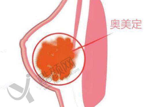 北京爱多邦医疗美容：对付生长因子有一手