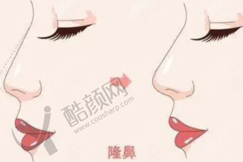 牛克辉隆鼻水平怎么样可靠吗？