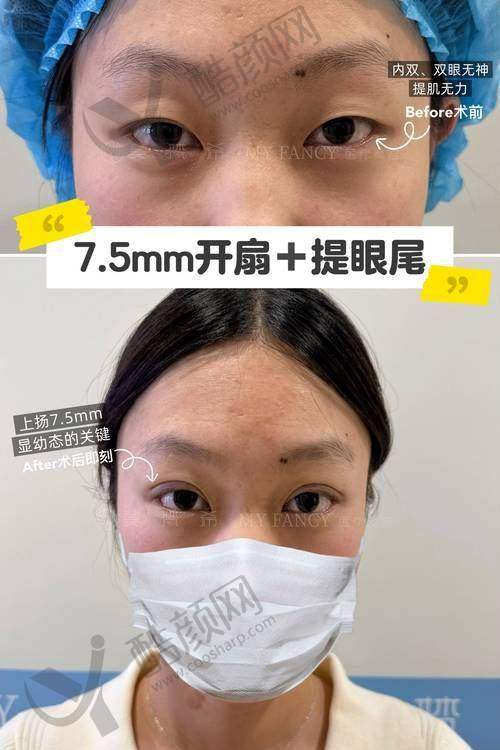 北京八大处高金波医生眼部整形水平怎么样可靠吗？