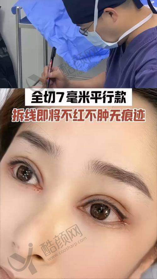 陈伟瀚医生项目价格表参考