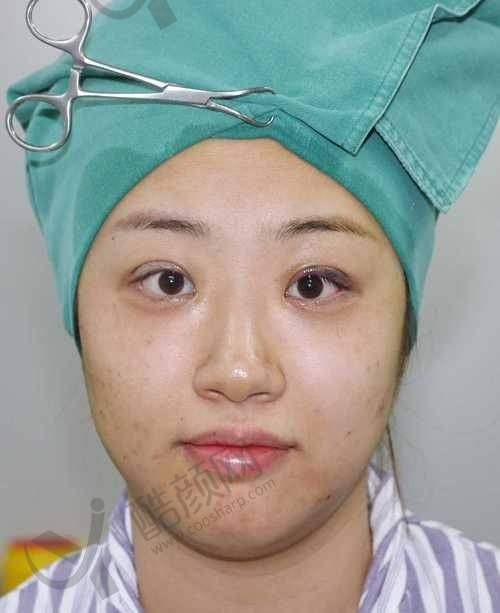 上海眼王张宇医生项目价格表参考