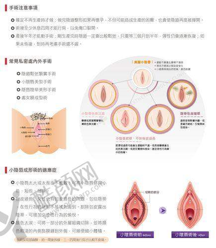 三、合肥民众医院私密科医生介绍: