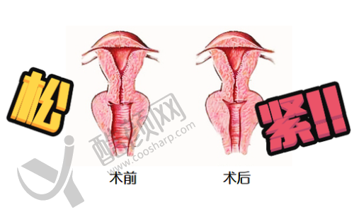 一、贵州贵阳西部医院私密科怎么样？
