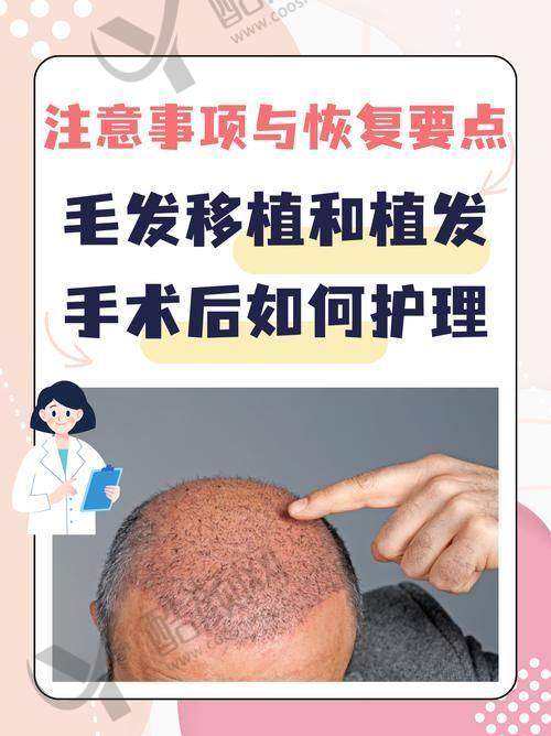 成都恒美植发：规模大实力强的专科连锁