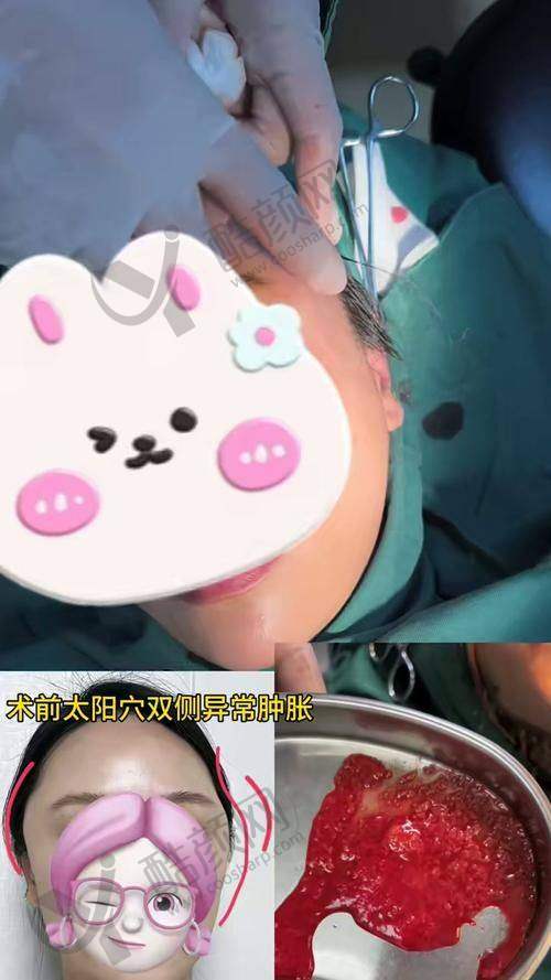 吴贞跃医生擅长项目：从馒化脸到眼鼻修复