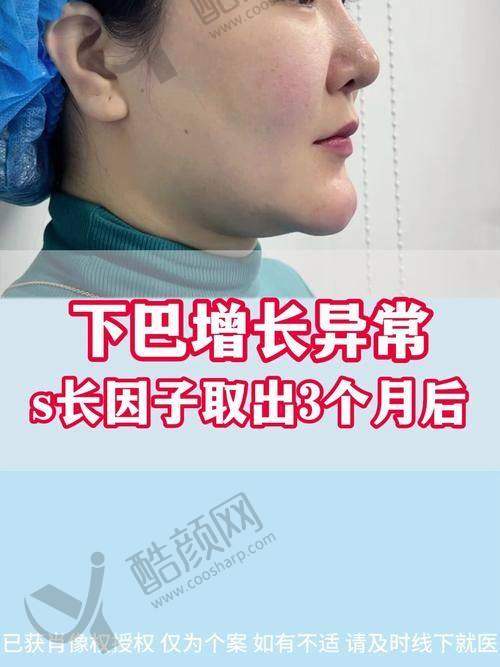 吴贞跃医生成功实例：真实成效见证实力