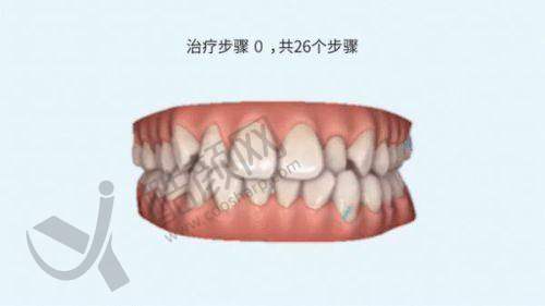刘兴华项目价格表参考