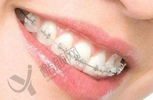 七、北京海淀中诺口腔医院真实的患者评价如下：
