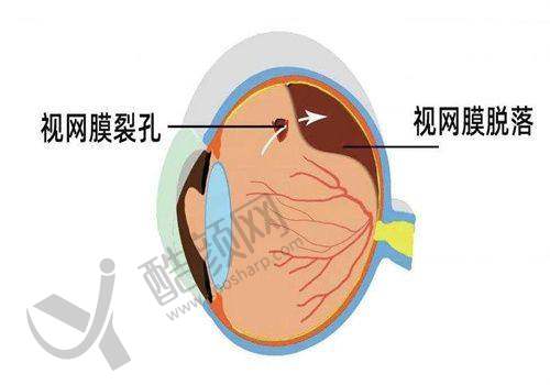昆明眼科医院的技术实力特点