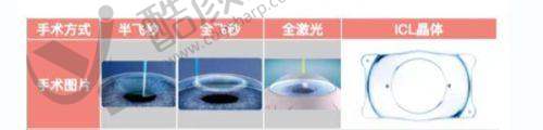 昆明眼科医院价格贵不贵?项目收费有范围