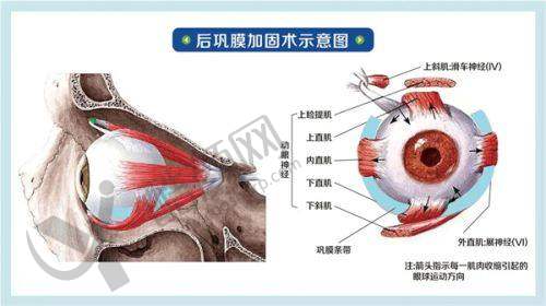 三、福州普瑞眼科医院是国有还是私立？