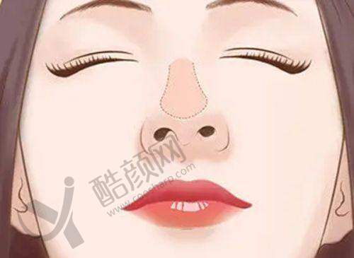 谭立文双眼皮修复水平怎么样可靠吗？