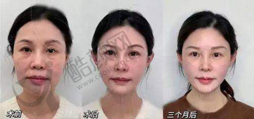 丽珠兰：成分的奥秘——PN成分的神奇功效