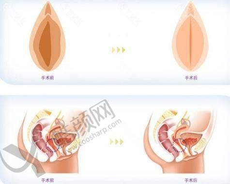 八、新疆石河子希望医院男女私密科实例：