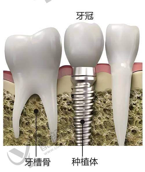 李佳怎么预约？