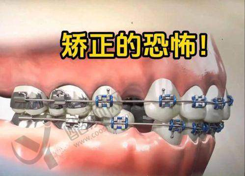 陈美占牙齿矫正水平怎么样可靠吗？