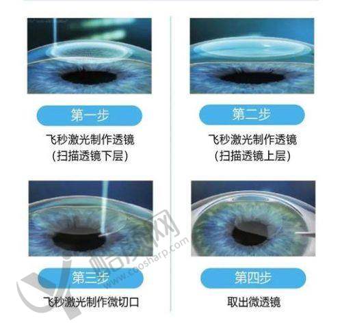 湖北武汉爱尔眼科汉口医院全飞秒手术具有影响力骨干医生介绍