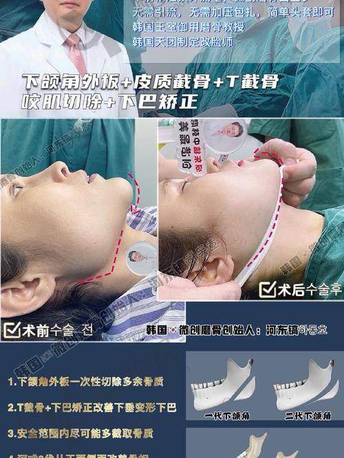 上海九院韦敏医生擅长项目优势
