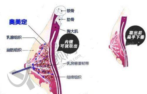 上海华美医疗美容医院：经验多技术优