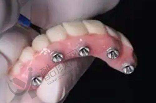 广州美云口腔医院的良好口碑